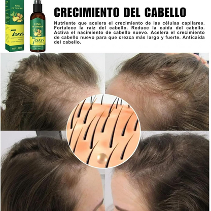 7 Days Crecimiento Capilar spray👨👩